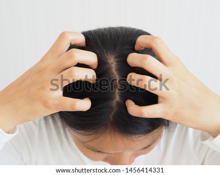 woman scratching her head cause of have a lice or louse and dandruff and scurf problem of scalp and hair treatment of peeling from allergy or lichen using for shampoo product concept.