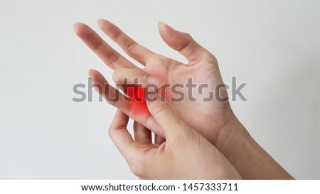 Trigger finger disease (locking finger or stenosing tenosynovitis disorder), hand anatomy with highlight on painful area. Patient has palm pain and catching of finger problem. Medical symptom concept Royalty-Free Stock Photo #1457333711