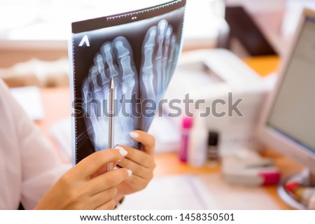 rheumatologist looking x-ray pictures of the patient's joints Royalty-Free Stock Photo #1458350501