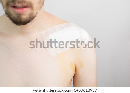 white caucasian male with a broken collarbone / clavicle / clavicula after surgery with a band aid after a bike crash