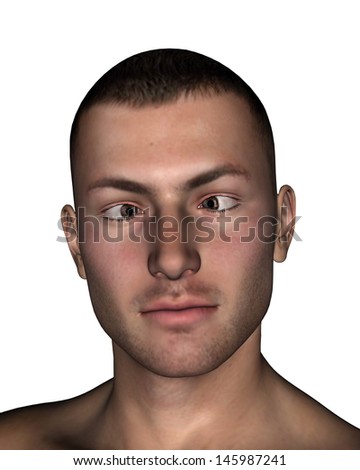 Young man presenting esotropia, eyes turns inward, in white background