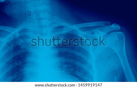 Shoulder x ray anatomy radiology. Radiographic Anatomy - Hand AP Medical Coding, Anatomy And Physiology color on black background