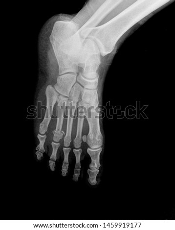 Pedis x ray anatomy radiology. Radiographic Anatomy - Hand AP Medical Coding, Anatomy And Physiology color on black background