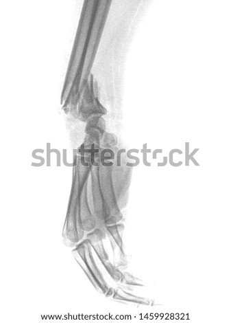 Wrist x ray anatomy radiology. Radiographic Anatomy - Hand AP Medical Coding, Anatomy And Physiology color on black background