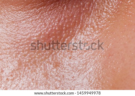 Oily Skin under the eyes texture on the face of the woman. Royalty-Free Stock Photo #1459949978