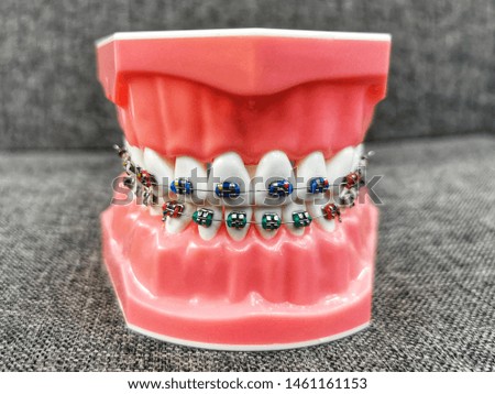 Orthodontic model and dentist tool, Dental hygienist checkup concept with teeth model, Regular checkups are essential to oral health. 