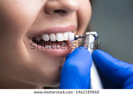 process of using stomatological brush as a stage of professional dental cleaning procedure in clinic close up Royalty-Free Stock Photo #1462189868