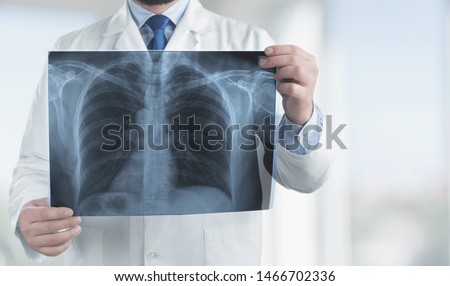 Doctor with radiological chest x-ray film for medical diagnosis on patient health on asthma, lung disease and bone cancer illness, healthcare hospital service concept  Royalty-Free Stock Photo #1466702336