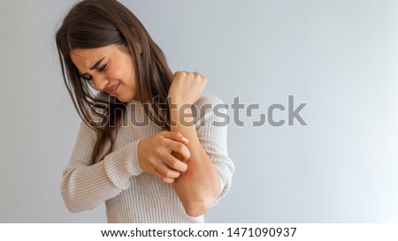 Young woman scratching arm from having itching on white background. Cause of itchy skin include insect bites, dermatitis, food/drugs allergies or dry skin. Health care concept. Close up. Royalty-Free Stock Photo #1471090937