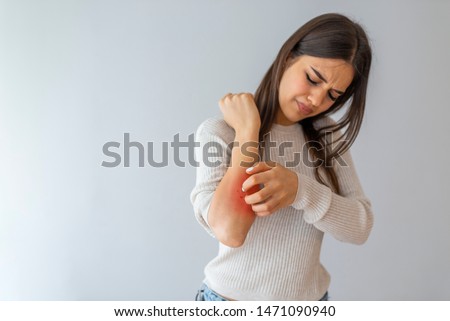 Health problem, skin diseases. Young woman scratching her itchy arm with allergy rash. Woman scratching her arm. Woman scratching arm indoors, space for text. Allergy symptoms Royalty-Free Stock Photo #1471090940