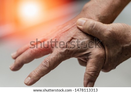 Trigger Finger problems. Woman’s hand with red spot o fingers as suffer from Carpal tunnel syndrome. The symptoms of tingling, numbness, weakness, or pain of the fingers and wrist. 