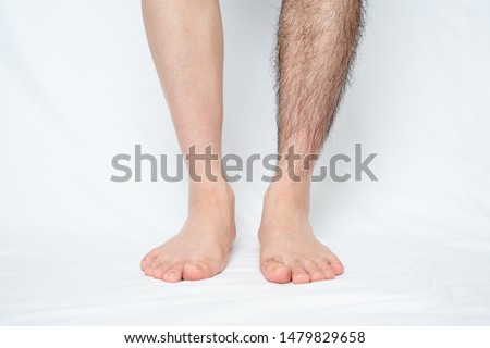 Legs hair removal for men, before & after. Applies to one leg only. Royalty-Free Stock Photo #1479829658