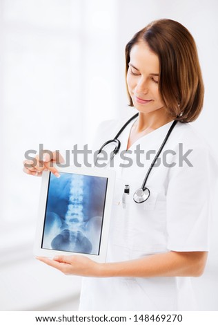 healthcare, medical and technology concept - female doctor with x-ray on tablet pc