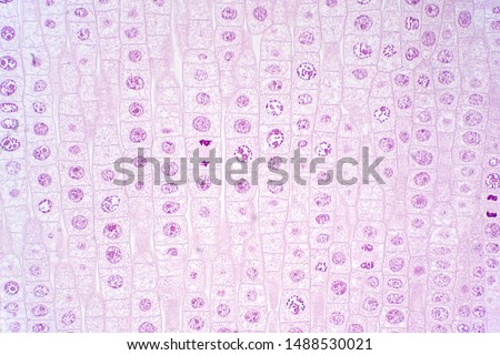Root tip of Onion show Mitosis cell in the Root tip under the microscope view. Royalty-Free Stock Photo #1488530021