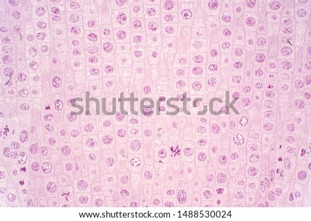 Root tip of Onion show Mitosis cell in the Root tip under the microscope view. Royalty-Free Stock Photo #1488530024