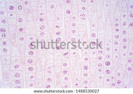 Root tip of Onion show Mitosis cell in the Root tip under the microscope view. Royalty-Free Stock Photo #1488530027