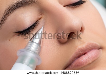 Macro close up of woman having noninvasive cosmetic facial with plasma pen. Cone shaped device doing skin tightening under eye. Royalty-Free Stock Photo #1488870689
