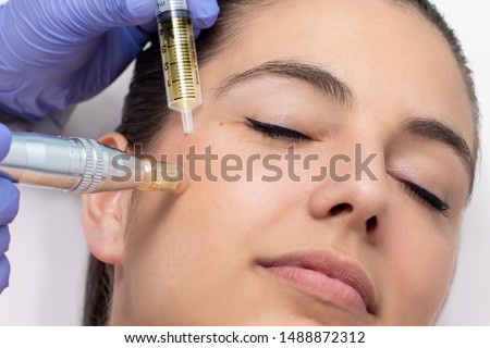 Close up of young woman having cosmetic mesotherapy facial. Therapist injecting pharmaceuticals with derma pen on cheek. Royalty-Free Stock Photo #1488872312