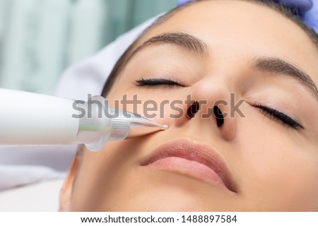 Macro detail of cone shaped plasma pen reducing wrinkles around cheek on young woman. Noninvasive cosmetic treatment. Royalty-Free Stock Photo #1488897584