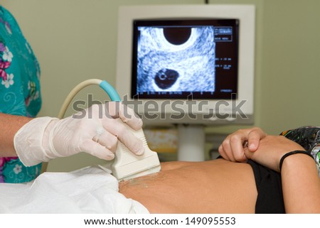 Sonographer technician holds an ultrasound transducer to diagnose the condition of a pregnant woman with a view of the woman's uterus on the computer screen. Royalty-Free Stock Photo #149095553