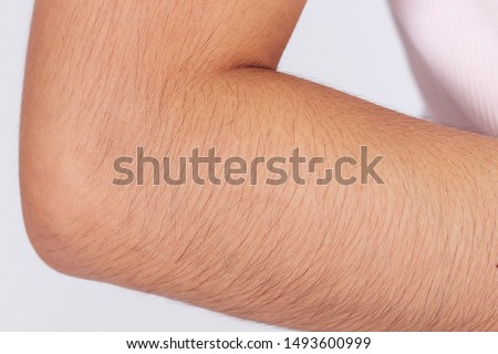CLOSE UP, Skin in close-up view raised woman arm hairy.