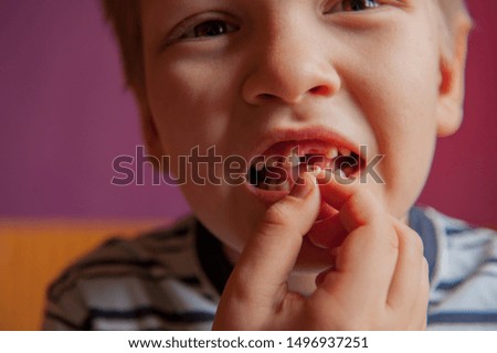 Cute baby shows dropped baby tooth. Boy smiles with toothless mouth. Striped home pajamas, proton purple background