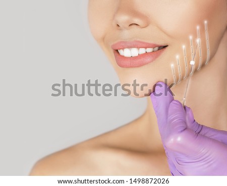 holographic mesothreads on the female face contour. Facelift procedure using mesothreads. Anti-aging skin lifting Royalty-Free Stock Photo #1498872026