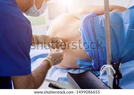 Epidural anesthesia injections. Prepare for surgery. Medical background Royalty-Free Stock Photo #1499086655