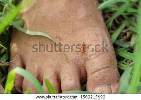 A small ants are biting at the feet of little children walking on the green lawn