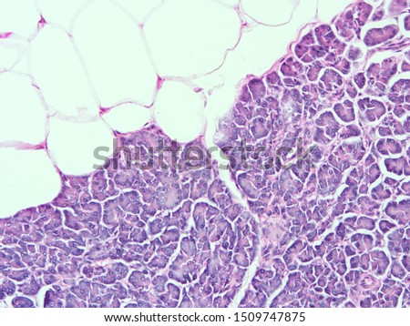 picture of histology human pancreas tissue with microscopefrom laboratory (not Illustration Designation)