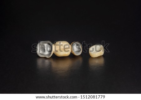 Dental veneers, ceramic and zirconium crowns of teeth close-up macro isolate on black background. Laboratory technical production  prostheses