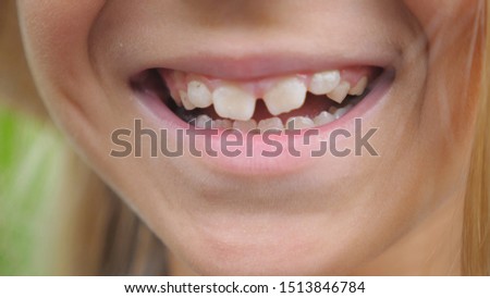 Close up mouth of small cute girl with blonde hair smiling and showing white teeth. Cheerful little kid laughing into camera with joyful smile. Detail view on happy child face. Front view Slow motion