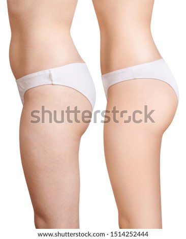 Side view on female legs and buttocks before and after slimming and treatment. Isolated on white background.