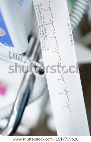 Close up of cardiologist doctor  holding and reading ekg paper print report of heart disease patient in the operating room before operation.Seriously case heart patient monitoring concept.