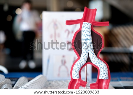 focus at a model of endovascular aneurysm repair (evar) for people education Royalty-Free Stock Photo #1520009633