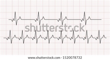 Cardiogram. Heart beat. Heartbeat line. Electrocardiogram. Vector  Royalty-Free Stock Photo #1520078732