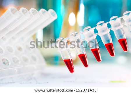 Plastic tubes with red samples for PCR reaction to analyse DNA
