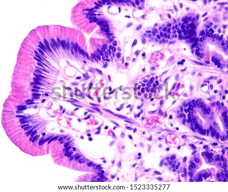 SURFACE-COLUMNAR-EPITHELIUM-DIGESTIVE-SYSTEM Stock Photos and Images ...