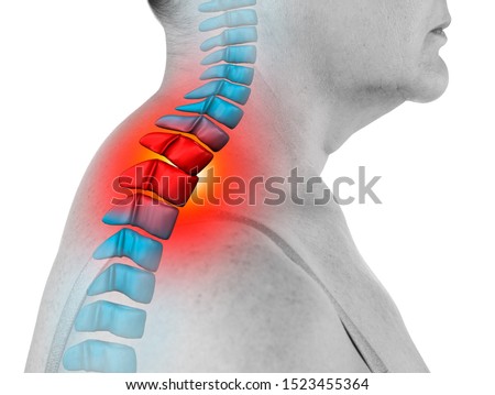 Neck pain, sciatica and scoliosis in the cervical spine isolated on white background, chiropractor treatment concept, painful area highlighted in red and blue Royalty-Free Stock Photo #1523455364