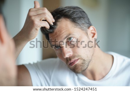 Portrait of a man worried about hair loss Royalty-Free Stock Photo #1524247451