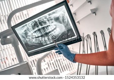 Image of doctor or dentist presenting with tooth x-ray film recommend patient in the treatment of dental and dentistry, working at workplace. Royalty-Free Stock Photo #1524353132