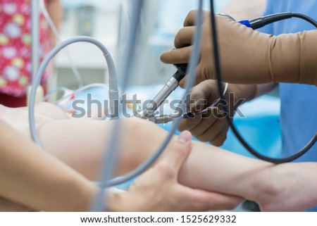 A team of urologist doctors performing a cystoscopy using a cystoscope. In a sterile operating room. close-up Royalty-Free Stock Photo #1525629332