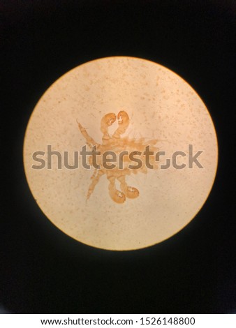 Pubic louse (Phthirus pubis) adult stage in light microscope