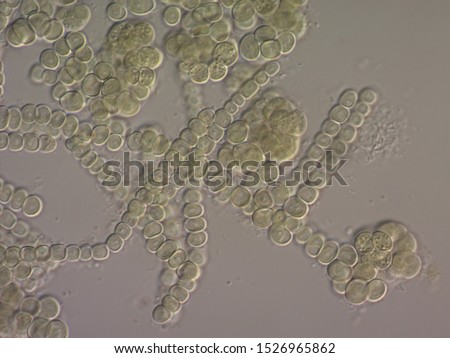 Filamentous blue-green algae (cyanobacteria) in the colony Royalty-Free Stock Photo #1526965862