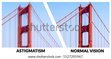 Example of vision with Astigmatism. It is a type of refractive error in which the eye does not focus light evenly on the retina. This results in distorted or blurred vision at all distances Royalty-Free Stock Photo #1527205967