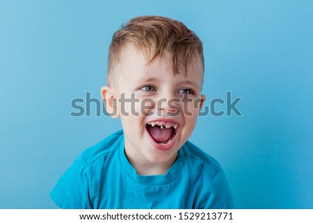 Extensive early dental caries and misaligned and spare incisor teeth in upper jaw. Royalty-Free Stock Photo #1529213771
