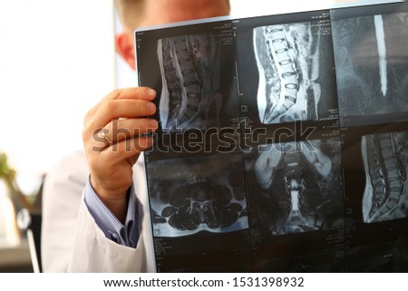 GP holding in arms vertebral CT scan detecting problem closeup