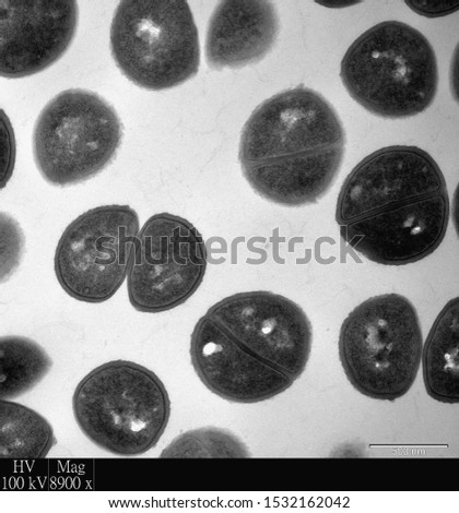 Transmission electron microscopy image of bacteria showing Staphylococcus undergoing binary fission. We can see both dividing and divided cells. Royalty-Free Stock Photo #1532162042