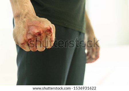 Aggressive violent man in a fight, with a bloody fist. Royalty-Free Stock Photo #1536931622