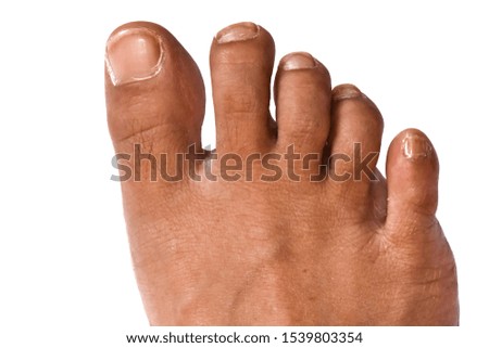 A close up picture of a toenail  On a white background, top view